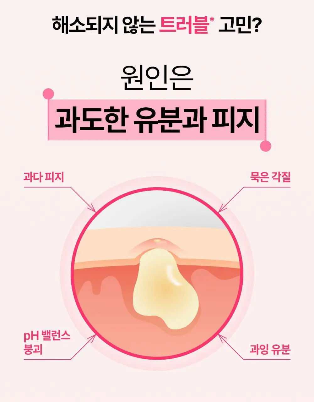 [트러블 피부 추천/저자극 각질 케어] 제로이드 핌프로브 토너 200ml 상세페이지 11